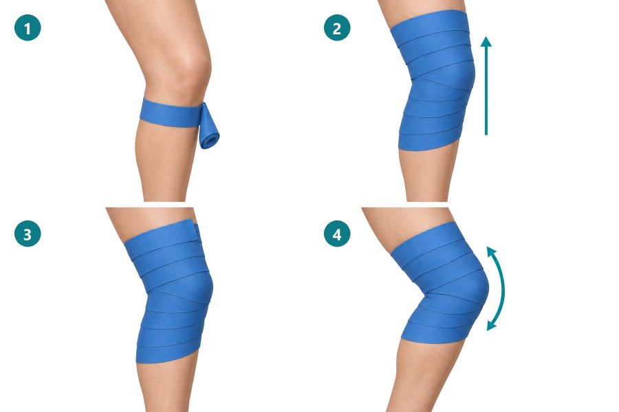 Vier Schritte am Knie: Anker unterhalb der Kniescheibe, aufwärts wickeln mit halber Überlappung und bedeckter Kniescheibe, Ende am Oberschenkel fixieren, Knie beugen und strecken.